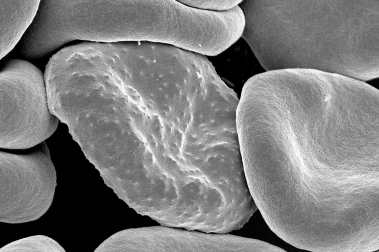 Gambar mikroskop elektron sel darah merah yang terinfeksi Plasmodium falciparum, penyebab malaria pada manusia| Gambar oleh Rick Fairhurst and Jordan Zuspann, National Institute of Allergy and Infectious Diseases, National Institutes of Health. Public Domain.