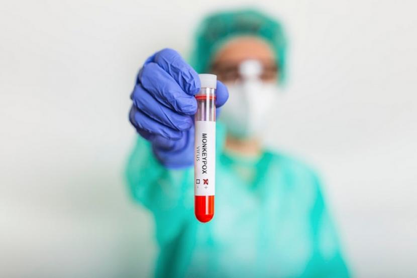 Petugas kesehatan memperlihatkan sampel swab cacar monyet Ilustrasi Dua pasien mpox di Malaysia sudah sembuh